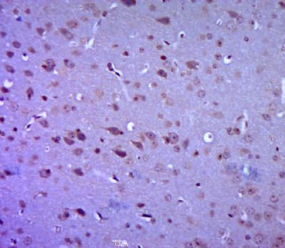 GPR49 G蛋白偶联受体49抗体