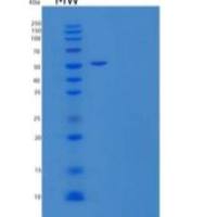 人KIR2DL3/NKAT2/CD158b2重组蛋白C-Fc