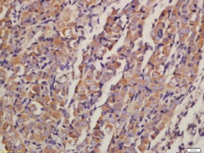 AKT1+2+3蛋白激酶AKT1,2,3抗体