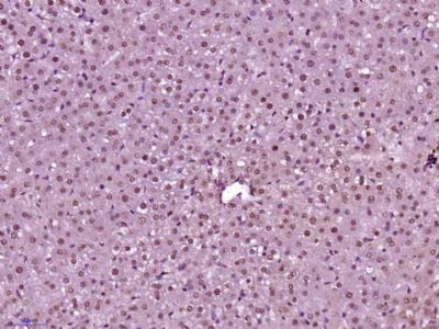 phospho-CDKN1A/p21 (Thr145)磷酸化