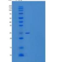 小鼠SLAM/CD150重组蛋白C-6His