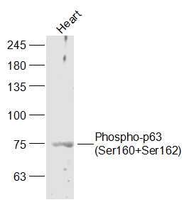 Phospho-p63 (Ser160+Ser162)磷酸化