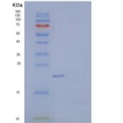 小鼠趋化因子16/CXCL16/SR-PSOX重组蛋白C-6His