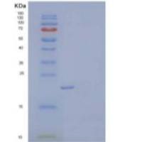 小鼠趋化因子16/CXCL16/SR-PSOX重组蛋白C-6His