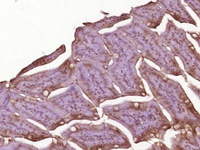 Cyclin B1周期素B1抗体