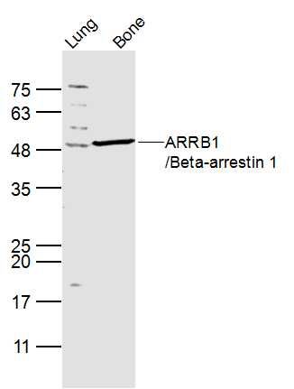 ARRB1/Beta-arrestin 1 antibody