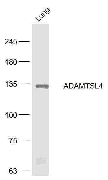ADAMTSL4整合素样金属蛋白酶与凝血酶样4蛋白抗体