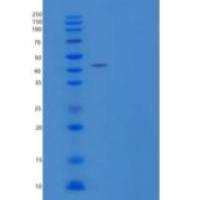 人CD27配体/肿瘤坏死因子SF7/CD70重组蛋白C-Fc