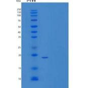小鼠血小板受体Gi24/VISTA/B7-H5重组蛋白C-6His