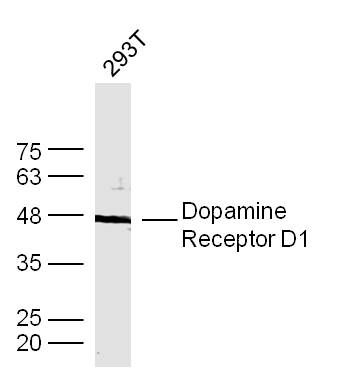 Dopamine Receptor D1多巴胺受体D1抗体