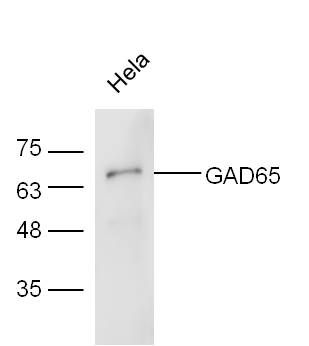 GAD65谷氨酸脱羧酶-65抗体