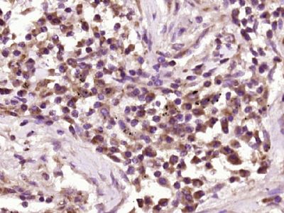 GIMAP2 GTP酶IMAP家族成员2抗体