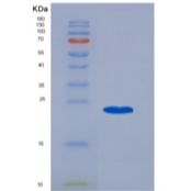 人CD20 / MS4A1重组蛋白TrxA Tag