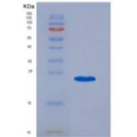 人CD20 / MS4A1重组蛋白TrxA Tag