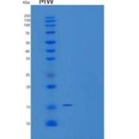人第十六组磷脂酶A1/A2/PLA2G16重组蛋白N-6His