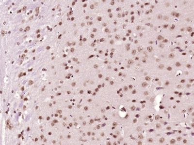 NADPH oxidase 4 antibody