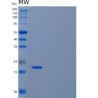 人超氧化物歧化酶重组蛋白C-6His, Cells