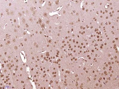 phospho-Src (Ser75) antibody