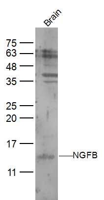 NGFB神经生长因子β抗体
