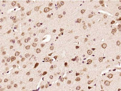 phospho-ERK1/2 (Thr202 + Tyr20