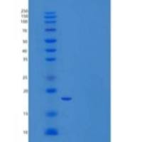 人真核翻译起始因子5A-2/EIF5A2重组蛋白N-6His
