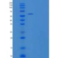 人肌苷-5'-单磷酸脱氢酶2(IMPDH2)重组蛋白N-6His