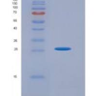 人肿瘤坏死因子配体超家族成员9(TNFSF9)重组蛋白