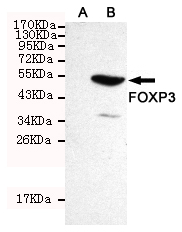 FOXP3 Mouse mAb