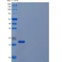 人Myc相关因子X重组蛋白