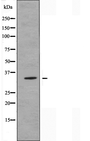 OR52E1 Antibody