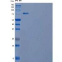 人酪氨酸蛋白激酶受体Tie-1/Tie-1重组蛋白C-6His