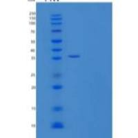 人钙黄绿素（Calumenin）重组蛋白