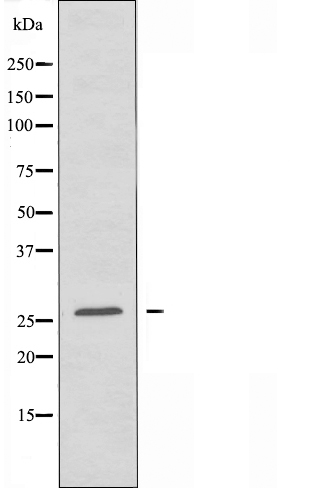 HOXA6 Antibody