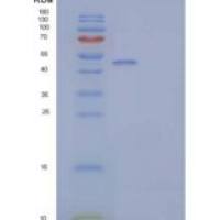 人胰脂肪酶相关蛋白2/PLRP2重组蛋白C-6His