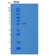 人含CUB结构域的蛋白1重组蛋白