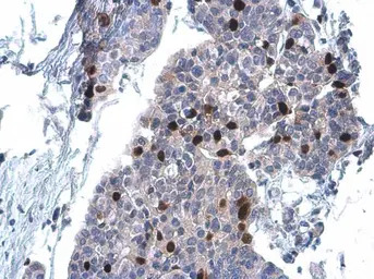 Cyclin A2 antibody [GT2547]