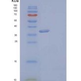 人醛酮还原酶1C3/AKR1C3重组蛋白C-6His