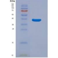 人补体成分3a(C3a)重组蛋白