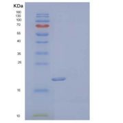 人尿嘧啶核苷磷酸化酶1(UPP1)重组蛋白N-6His