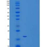 人胱抑素C/CST3重组蛋白N-6His
