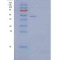 人玻连蛋白(VTN)重组蛋白C-6His