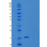 小鼠白介素17F(IL17F)重组蛋白C-6His