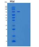 人血浆激肽释放酶/KLKB1重组蛋白C-6His