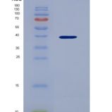 人趋化因子配体3（CXC L3）重组蛋白