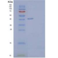 人Nogo-66受体相关3/ngr 3/rtn4r 1重组蛋白C-6His