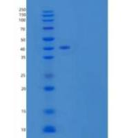 人二肽基肽酶1(DPP1)重组蛋白C-6His