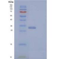 人含V-Set免疫球蛋白域蛋白8(VSIG8)重组蛋白