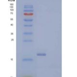 人PH样结构域A2/PHLDA2/BWR1C/IPL/TSSC3重组蛋白C-6His