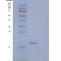 人PH样结构域A2/PHLDA2/BWR1C/IPL/TSSC3重组蛋白C-6His
