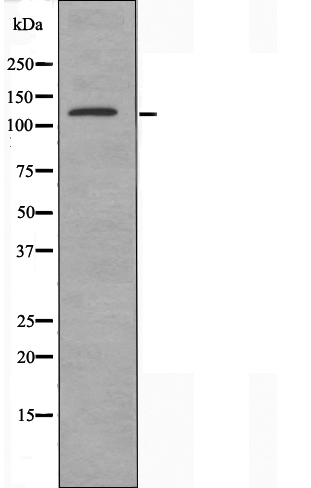 DGKD Antibody